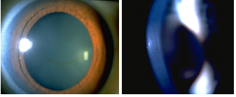 1137_Whats an optic section.png