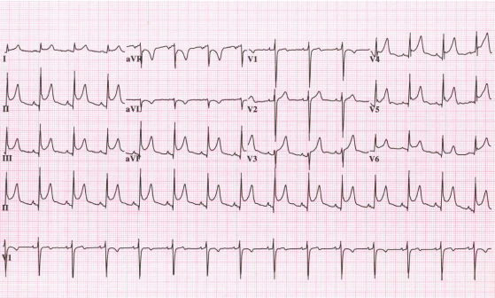 1708_Explain the factors that regulate blood flow1.png