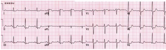 2103_Explain the factors that regulate blood flow3.png