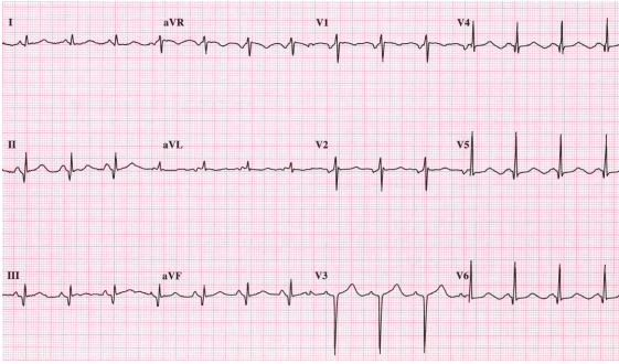 2287_Explain the factors that regulate blood flow2.png