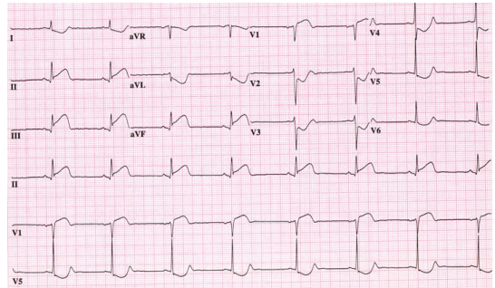 2412_Explain the factors that regulate blood flow.png