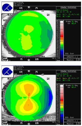 678_Whats an optic section1.png