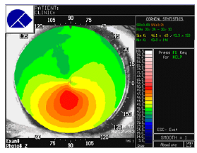 816_Whats an optic section2.png